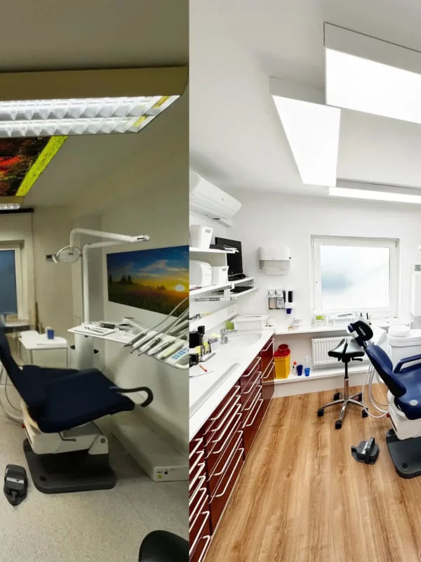 Comparaison avant-après de l’éclairage d’une salle de soins dentaires après le passage à l’éclairage LED